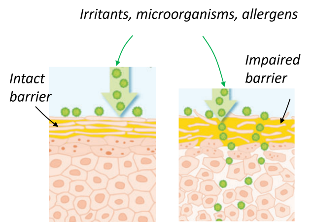Delivery-of-skin-calming-ingredient